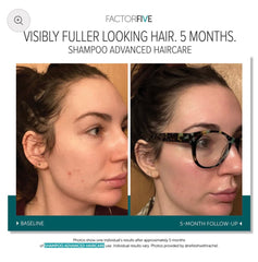 FACTORFIVE Shampoo Advanced Haircare