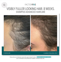 FACTORFIVE Shampoo Advanced Haircare